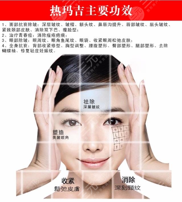 呼市热玛吉全脸多少钱？