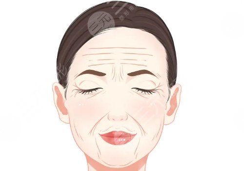 筋膜提升术多少钱？