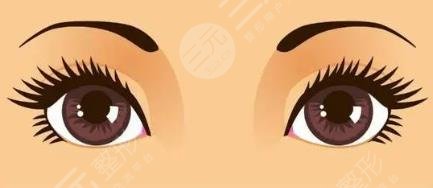 双眼皮