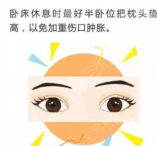 北京空军总医院整形外科双眼皮案例