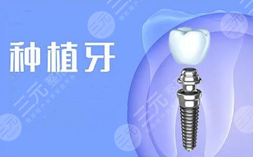 揭阳人民医院种牙案例分享