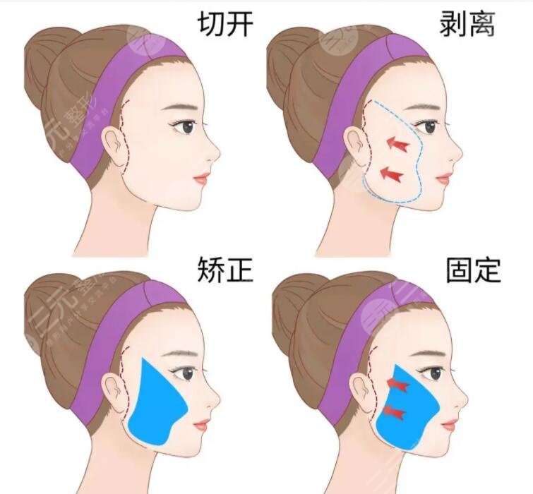 北京华韩医疗美容医院擅长项目介绍