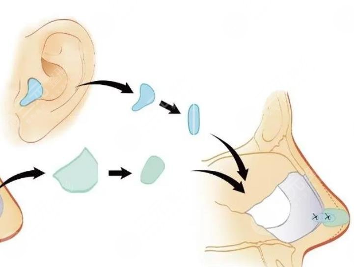 杭州美莱科室擅长项目科普