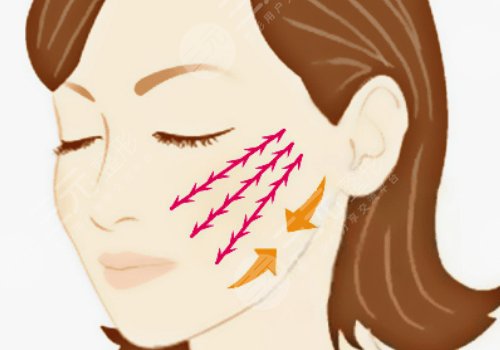 抗衰老项目做完之后会加快衰老吗？