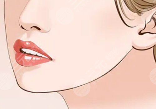 下颚整容手术一般要多少钱