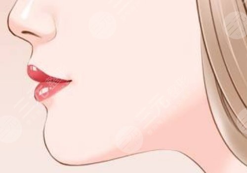 下颚整容手术一般要多少钱