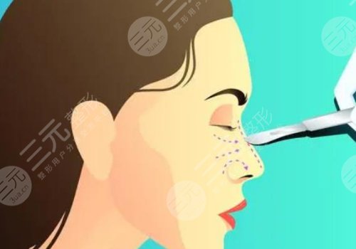 复旦大学附属华东医院整形科医生怎么样？