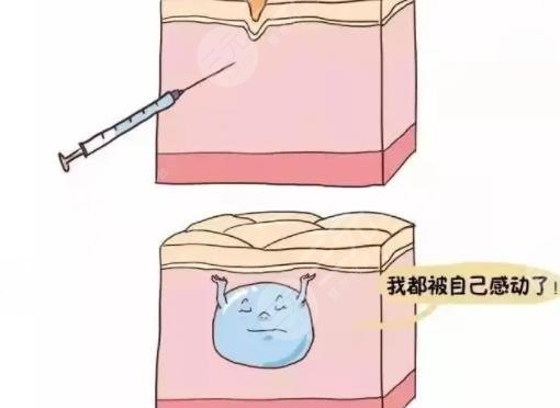玻尿酸