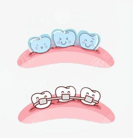 中山医院口腔科牙齿矫正案例