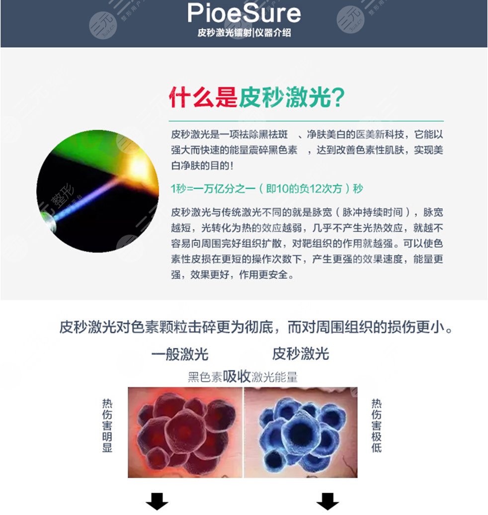 380元一次的皮秒是真还是假