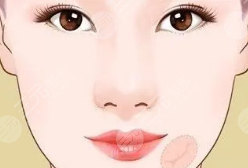 武汉三医院烫伤疤痕修复科烧伤科怎么样？