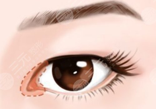 浙江医院整形科医生名单