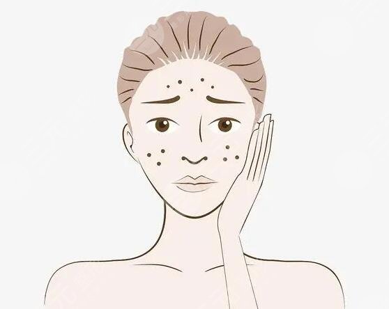 北大医院祛斑案例