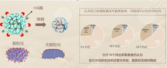 芙妮薇尊雅玻尿酸注射前需要注意哪些事项?