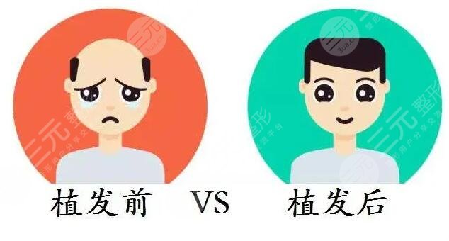 北京空军总医院植发案例分享