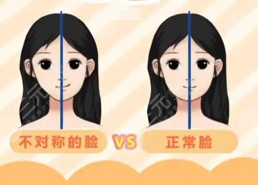 下颌骨一高一低脸歪矫正后需要怎样护理?