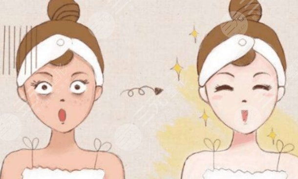 上海华山医院整形外科光子嫩肤前后对比照片