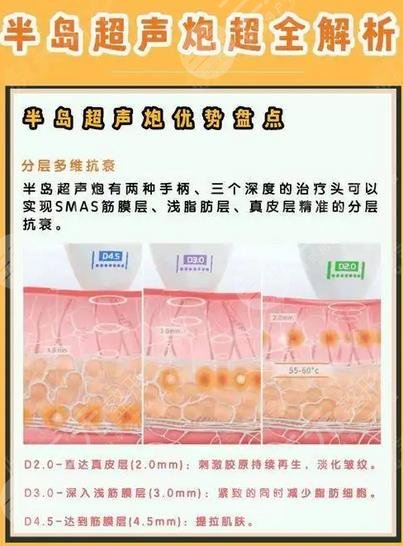 半岛黄金超声炮和超声炮的区别有哪些？