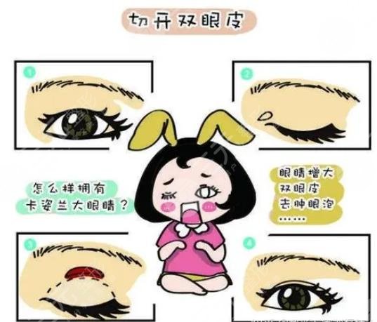 李哲权双眼皮怎么样