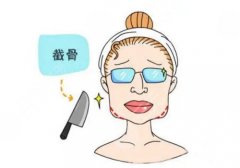 削骨三年后的案例曝光，脸型精致小巧，更上镜了