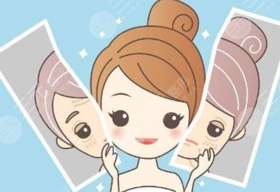 激光美白