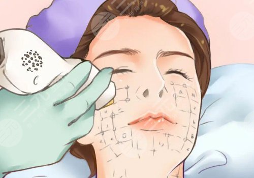 热玛吉不同能量的区别有哪些？