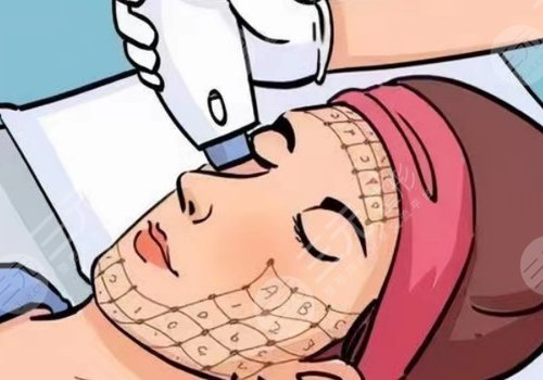 热玛吉是不是能量越高效果越好？