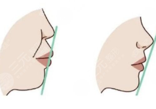 上海正颌医生高伟怎么样