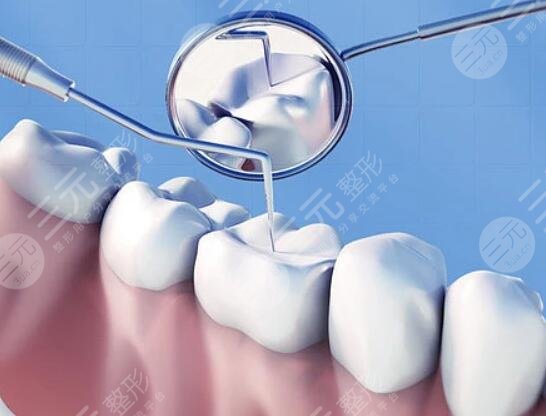 北京中关村医院牙科知识科普