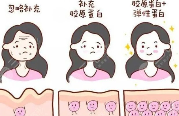 菲林普利胶原蛋白