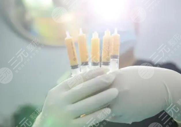 袁玉坤医生做自体脂肪丰胸价格是多少