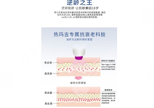 馒化脸做热玛吉好还是超声炮好