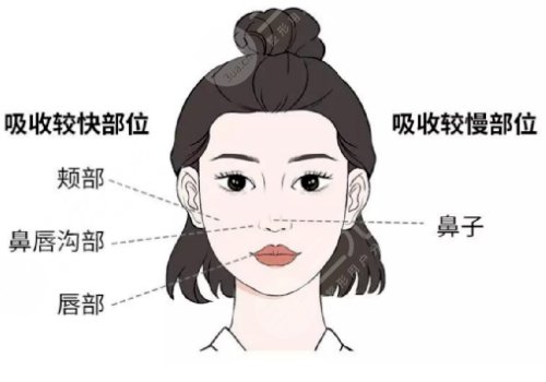 馒化脸做热玛吉好还是超声炮好