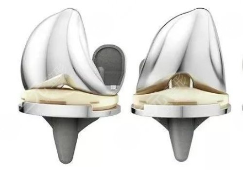 强生瑆珀假体缺点