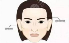 填充太阳凹陷脂肪能保持多久？科普小课堂！手术原理、价格查询~
