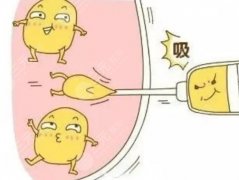 二次填充效果会比第一次好吗？面部轮廓塑造指南！