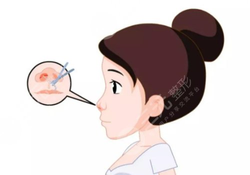 欧阳春鼻子做得怎么样