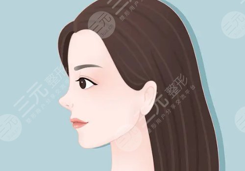 钟青杰医生做鼻子怎样？