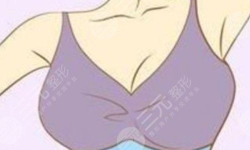 青岛曹继武隆胸怎么样？