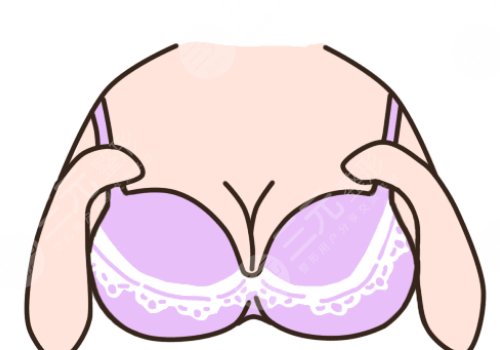 青岛曹继武隆胸怎么样？