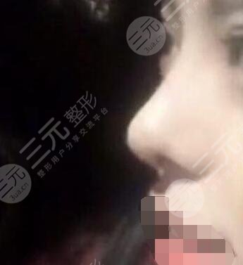 北京中关村医院美容整形科技术优势有哪些?