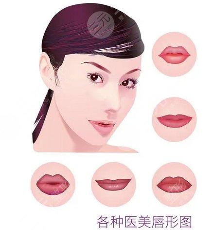 卢九宁医生整形案例