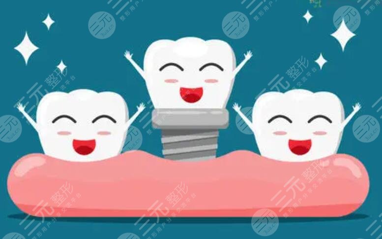 牙齿种植