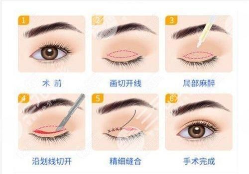 马传勋跟邹俊峰谁厉害？