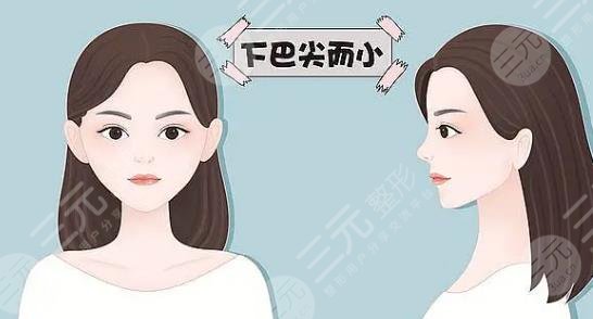 下巴