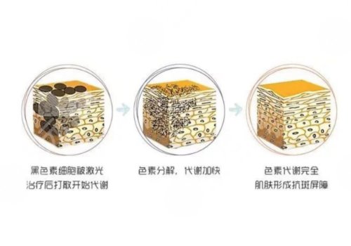 八大处皮秒价格