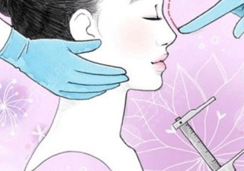 玻尿酸解决的面部问题有哪些