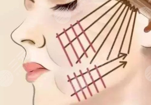 姨化脸是什么意思