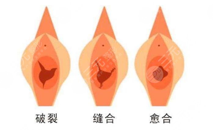 重庆亚美蜜园私密整形怎么样