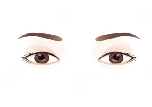 小切口双眼皮能坚持几年？